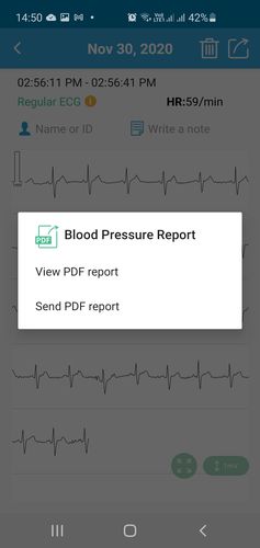 ECG share